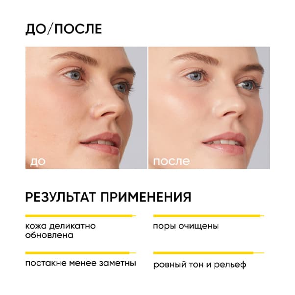 SMART SOFT RENEW Очищающий гель для умывания с кислотами