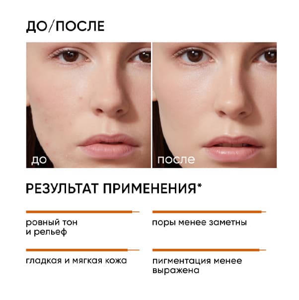 SMART 25% Интенсивный миндальный пилинг