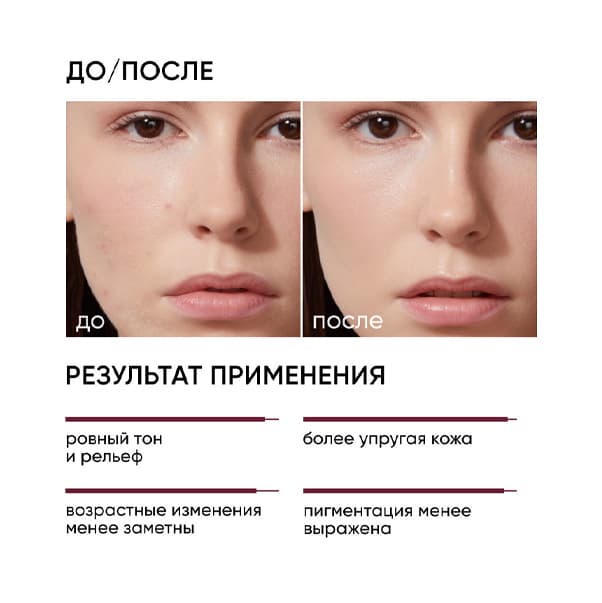 SMART 15% Омолаживающий пилинг с пептидами